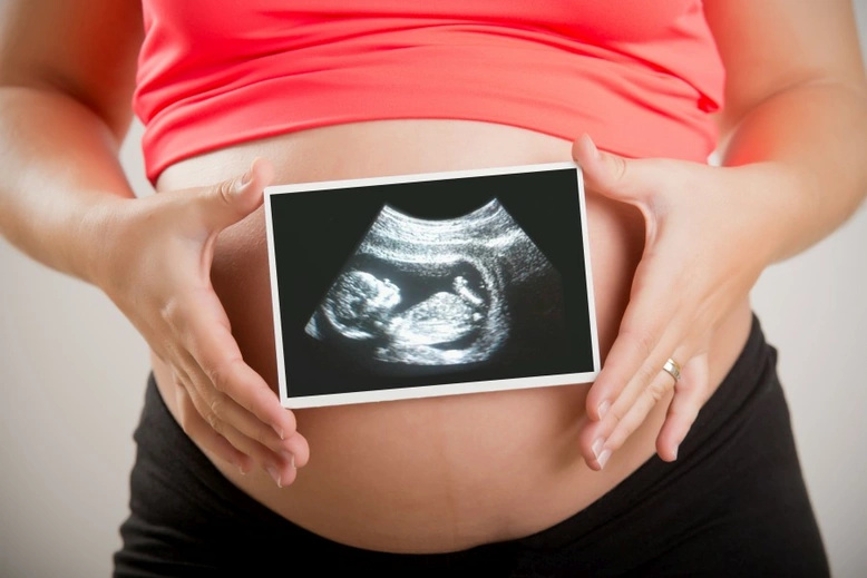 Schwangere mit Ultraschallbild – PKV und Schwangerschaft